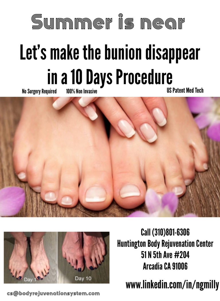 Huntington Body Rejuvenation bunion removal flyer